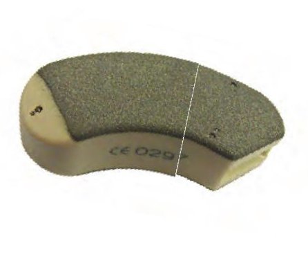 Adonis Exclusive TLIF 